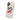 Autism Phone Case - Cherry on Top Phone Case - Daily Bloom